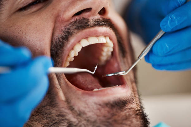 Best Full Mouth Reconstruction  in Pasatiempo, CA